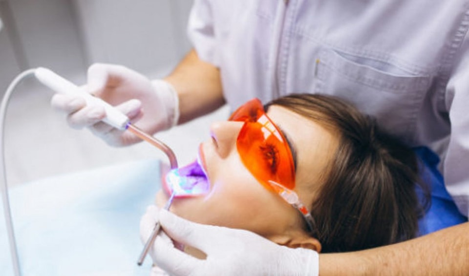 ¿Es recomendable realizarse un aclaramiento dental? ¿Es recomendable realizarse un aclaramiento dental?