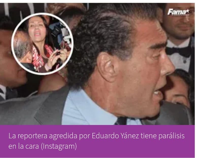 Se revela que la reportera ‘agredida’ por Eduardo Yánez sufre de PARÁLISIS facia